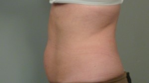 Tummy shot - side view, 5.11.'12